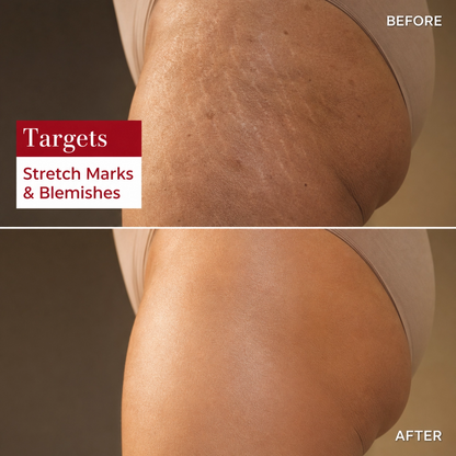 Velora™ Firming Body Glow Oil